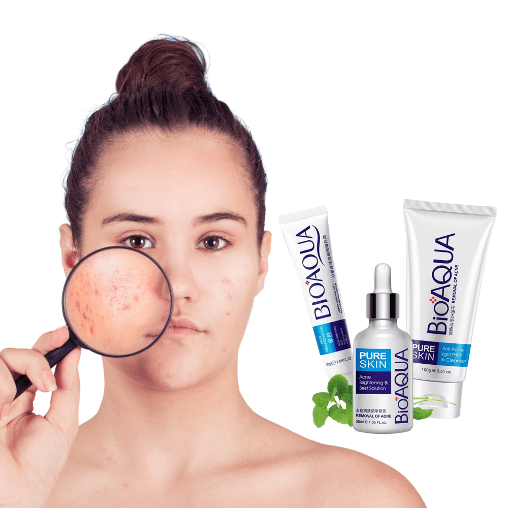 Kit Anti acné-  Rutina facial completa para piel con acné