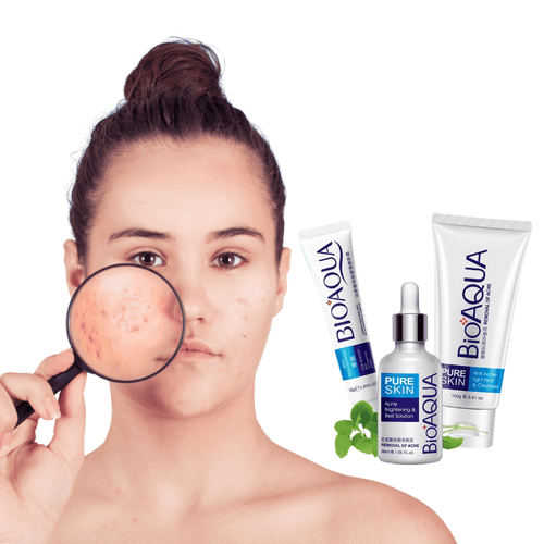 Kit Anti acné-  Rutina facial completa para piel con acné
